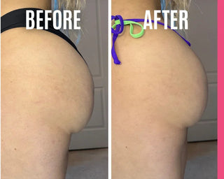 Booty Bloom™ – Brazilian Firming &  Lifting Cream (50ml) - BeautyBloom Hub