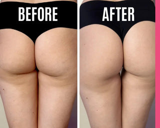 Booty Bloom™ – Brazilian Firming &  Lifting Cream (50ml) - BeautyBloom Hub